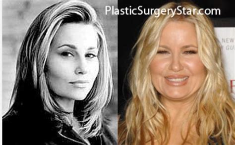 jennifer coolidge before surgery|Jennifer Coolidge Plastic Surgery: Shocking Before and After Look!